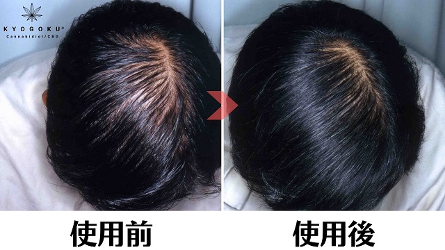 つむじはげ Kyogoku Salon